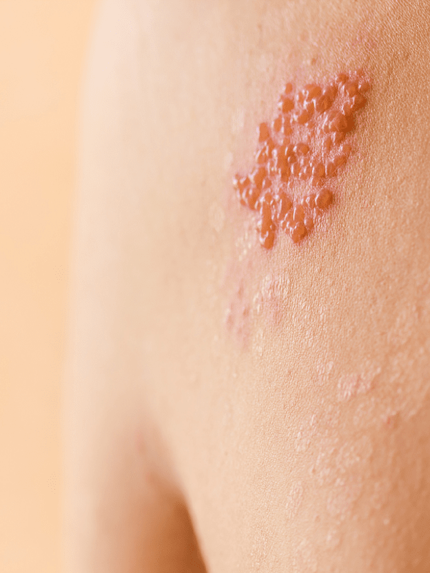 당해보지 않았으면 말을 하지 말아!