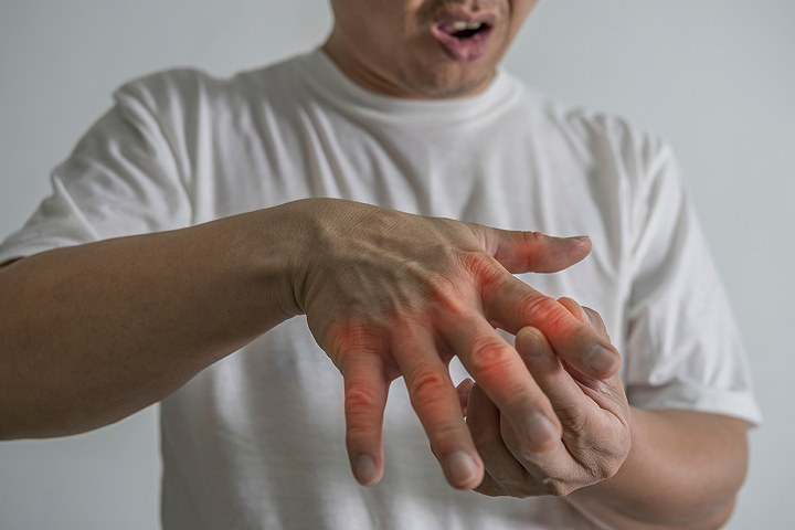 바람만 맞아도 아프다는 이 질환은?